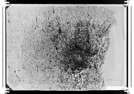 Fotomicrografia - Doença de Chagas