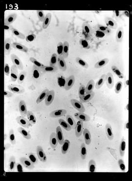 Fotomicrografia - malária aviária