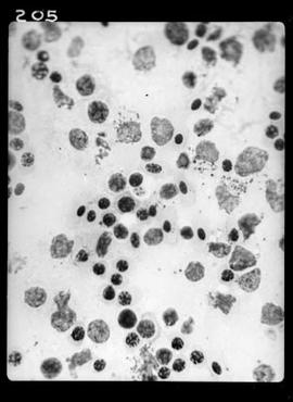 Fotomicrografia - malária aviária