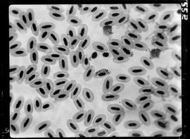 Fotomicrografia de malária aviária (fígado de tucano com malária)