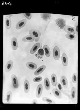 Fotomicrografia - Malária aviária (baço de tucano com malária)