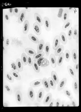 Fotomicrografia - Malária aviária (fígado de tucano com malária)