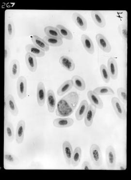 Fotomicrografia - Malária aviária (fígado de tucano com malária)