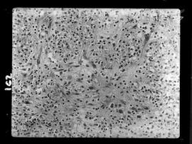 Fotomicrografia de Hanseníase experimental