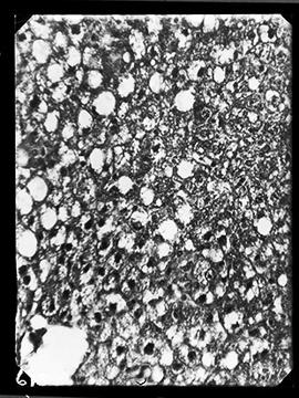 Fotomicrografia de fígado de rato aumentada 140 vezes