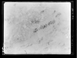 Fotomicrografia - bacilo da Hanseníase
