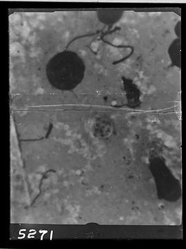 Fotomicrografia de pneumocystis