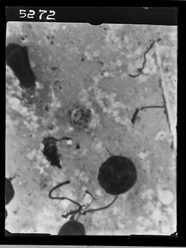 Fotomicrografia de pneumocystis