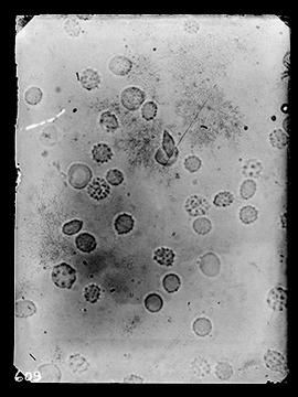 Fotomicrografia (sangue)