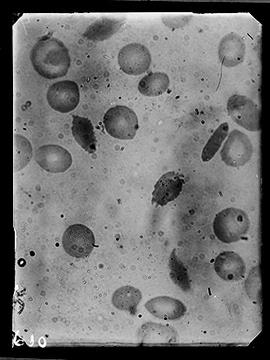 Fotomicrografia (sangue)
