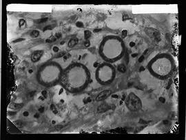 Fotomicrografia - Pseudo Coccidioides mazzai esporoblastos e formação de esporos (sequência 2 de 6)