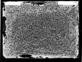 Fotomicrografia - Pseudo Coccidioides mazzai esporoblastos e formação de esporos (sequência 3 de 6)