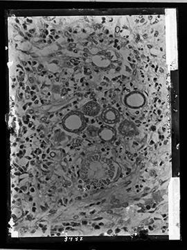 Fotomicrografia - Pseudo Coccidioides mazzai esporoblastos e formação de esporos (sequência 4 de 6)