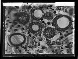 Fotomicrografia - Pseudo Coccidioides mazzai esporoblastos e formação de esporos (sequência 5 de 6)