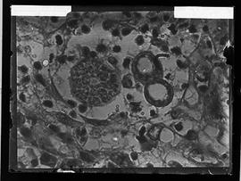 Fotomicrografia - Pseudo Coccidioides mazzai esporoblastos e formação de esporos (sequência 6 de 6)