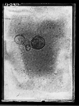 Fotomicrografia - hormodendrum pedrosoi cromoblastomicose