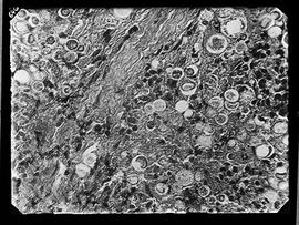 Fotomicrografia - Blastomicose (forma de parasita do homem)