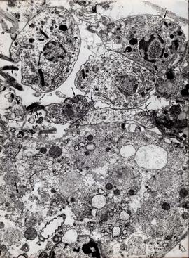 Microscopia eletrônica T.cruzi nos hemócitos