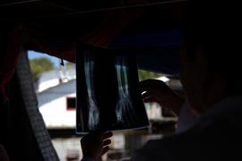 Abel Del Toro Pereza verificando chapa de raio x durante atendimento domiciliar