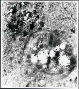 Aerograma - hemócito com parasita